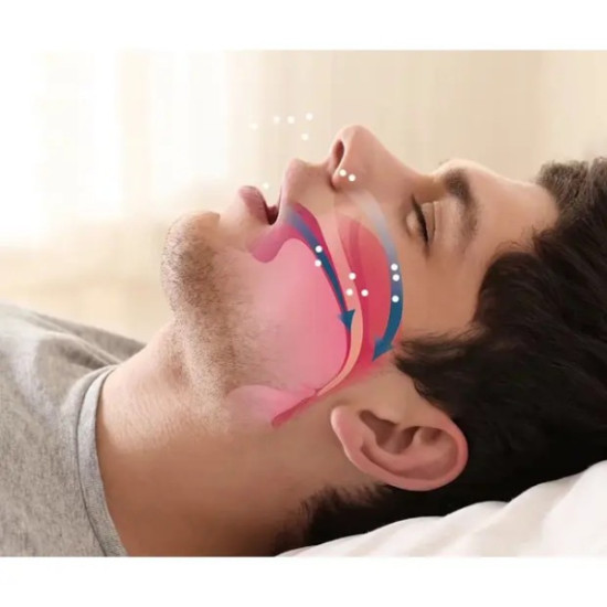 Horlama Önleyici Rahat Uyku Aparatı